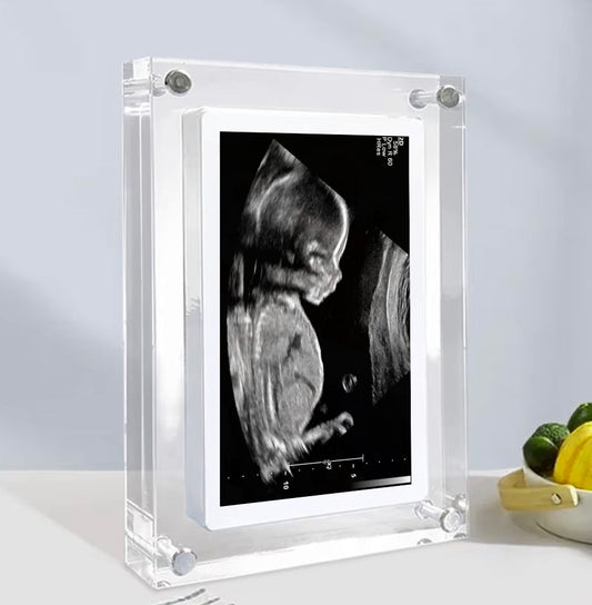 LivingFrame™ - The Digital Video Frame